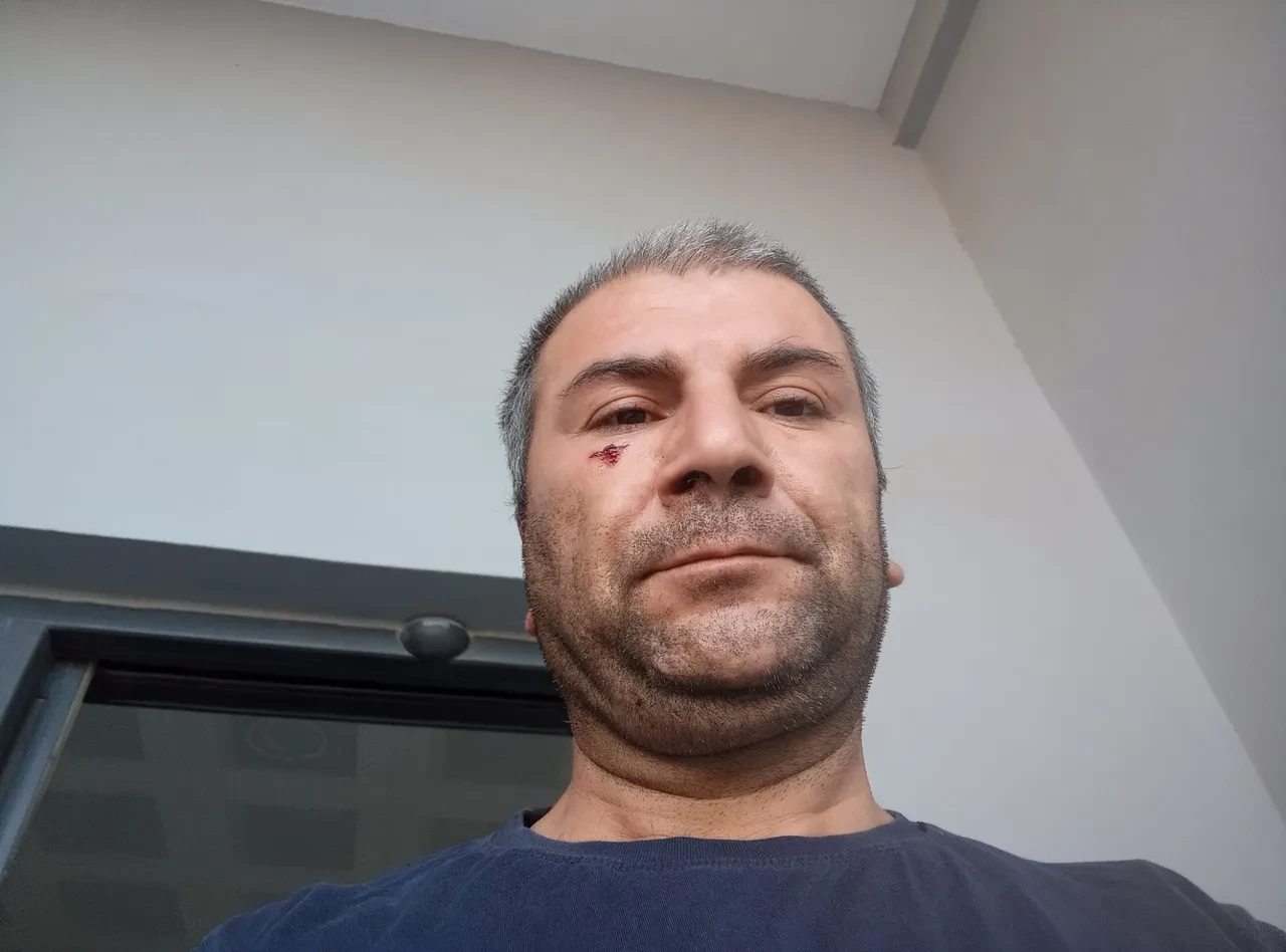 'Kenara çekilir misiniz' diyerek uyardı, başına gelmeyen kalmadı! Tüm mahalleden dayak yedi