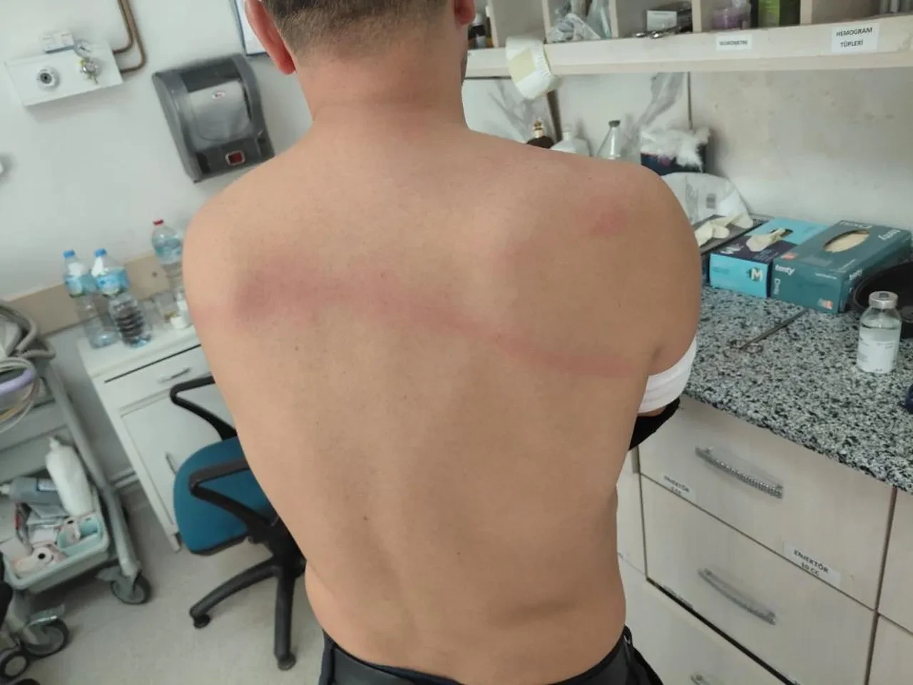 Zabıtaları sopayla dövdü! CHP'li dayakçı başkan hakkındaki iddianame tamamlandı! 