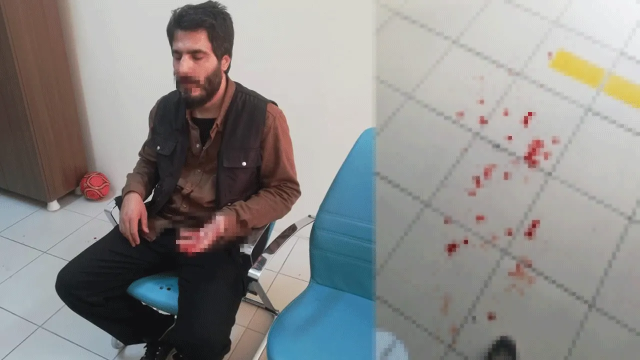 Bursa'da lisede dehşet! Öğrenciyi gasp edip müdür yardımcısının burnunu kırdılar