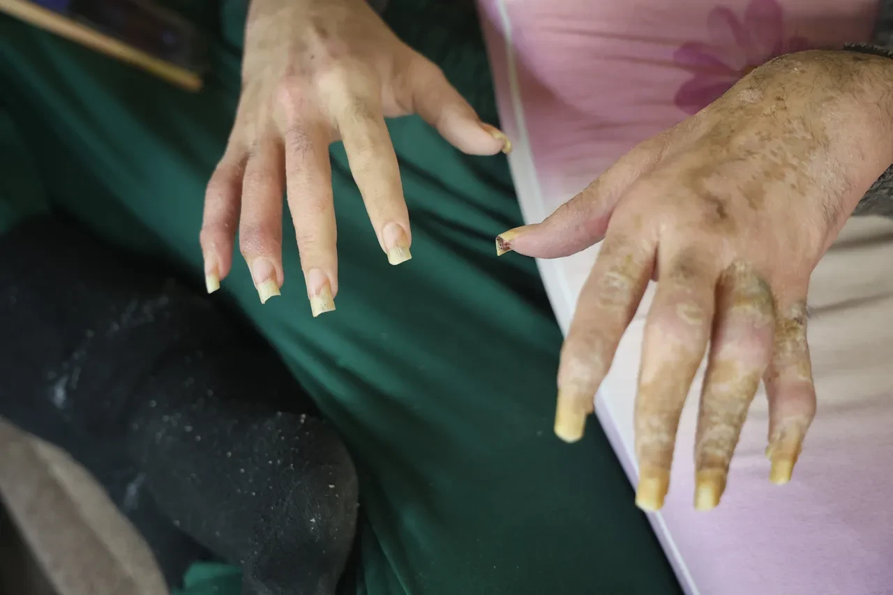 Evden adımını atmayan genç, 3 yıldır ne duş alıyor ne tırnaklarını kesiyor! İnanılmaz olayın nedeni yürek yaktı