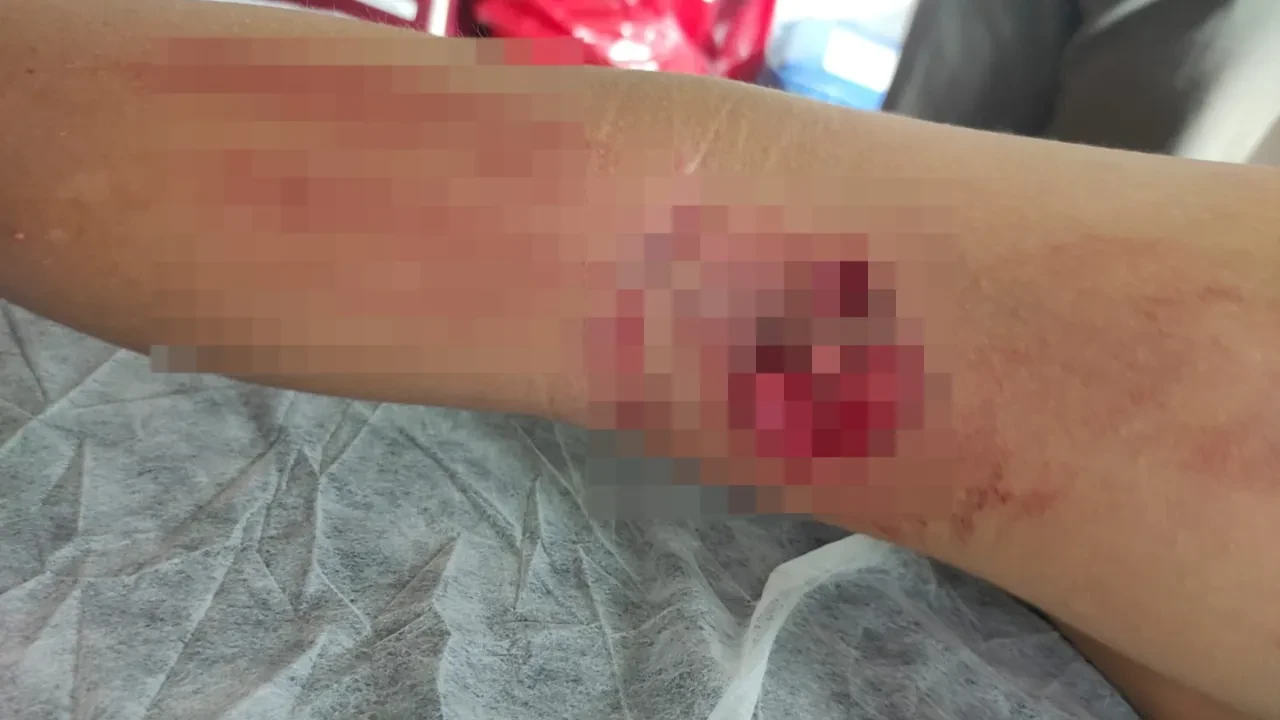 Başıboş sokak köpeği dehşeti! Küçük çocuk canını zor kurtardı