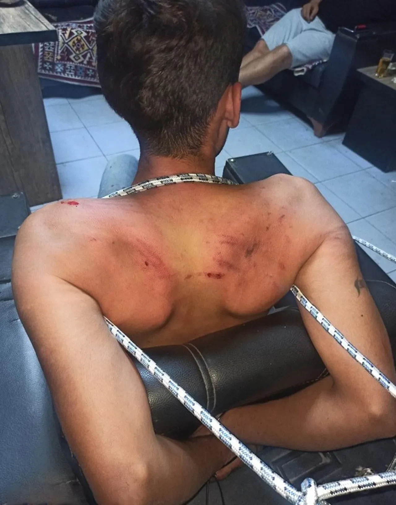 Dişlerini kırıp hamam böceği yedirdiler! 3 gün süren vahşet için istenen ceza belli oldu