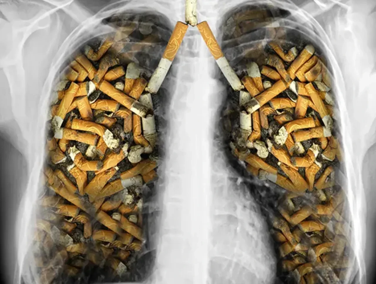 Tütünsüz Bir Türkiye için harekete geçildi! Sigara bıraktırma poliklinikleri açılıyor