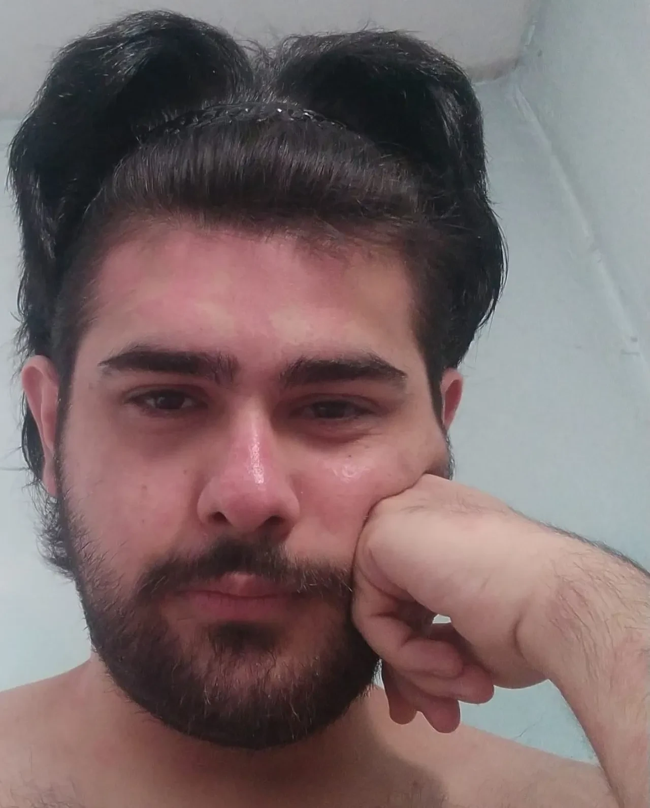 Yıllardır duş almayan, tırnaklarını kesmeyen gencin eski hali ortaya çıktı! 'Çok bakımlı biriydi'