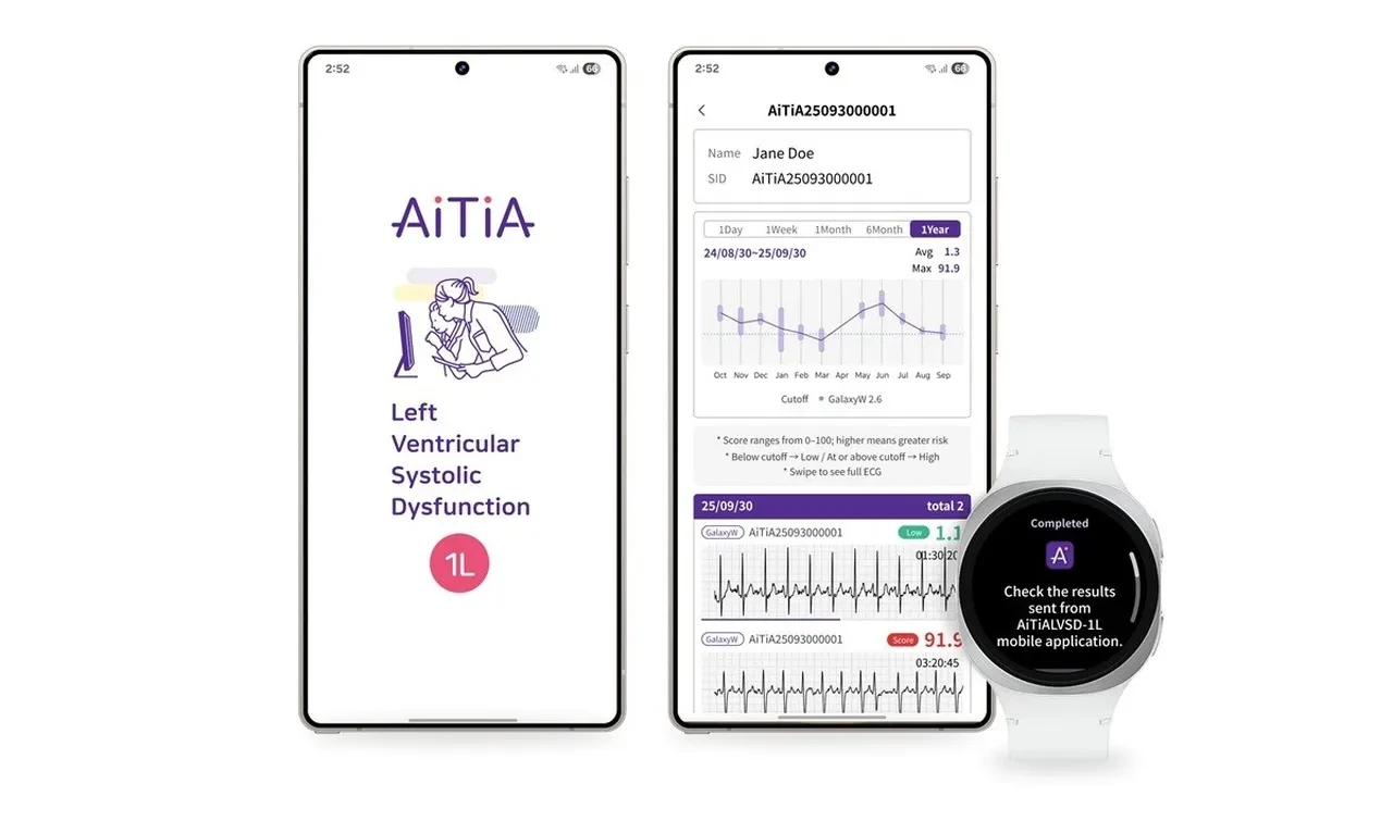 Samsung akıllı saatlere yeni özellik: Kalp yetmezliğini bile tespit edebilecek