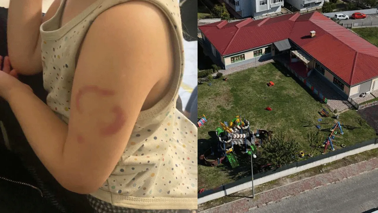 Kreşte akılalmaz olay! Öğretmen 3 yaşındaki kızı ısırdı savunası pes dedirtti!