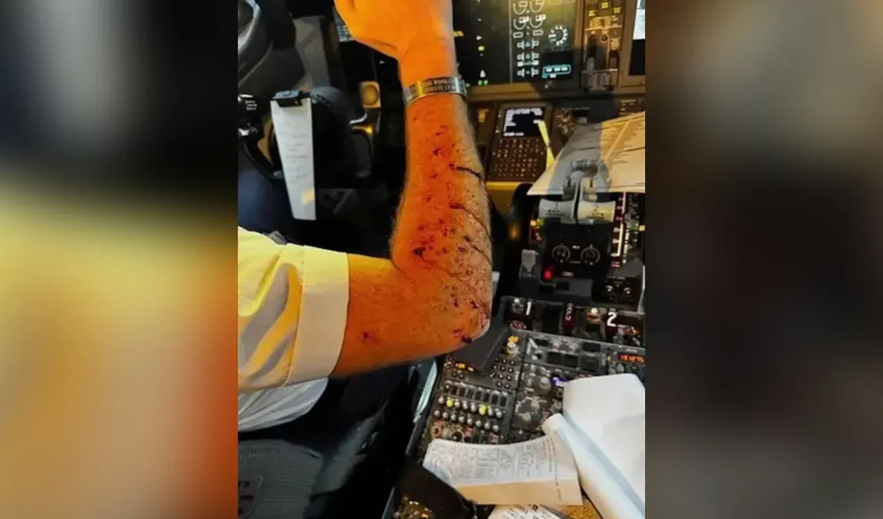 Yolcu uçağına meteor çarptı! Pilot kanlar içinde kaldı