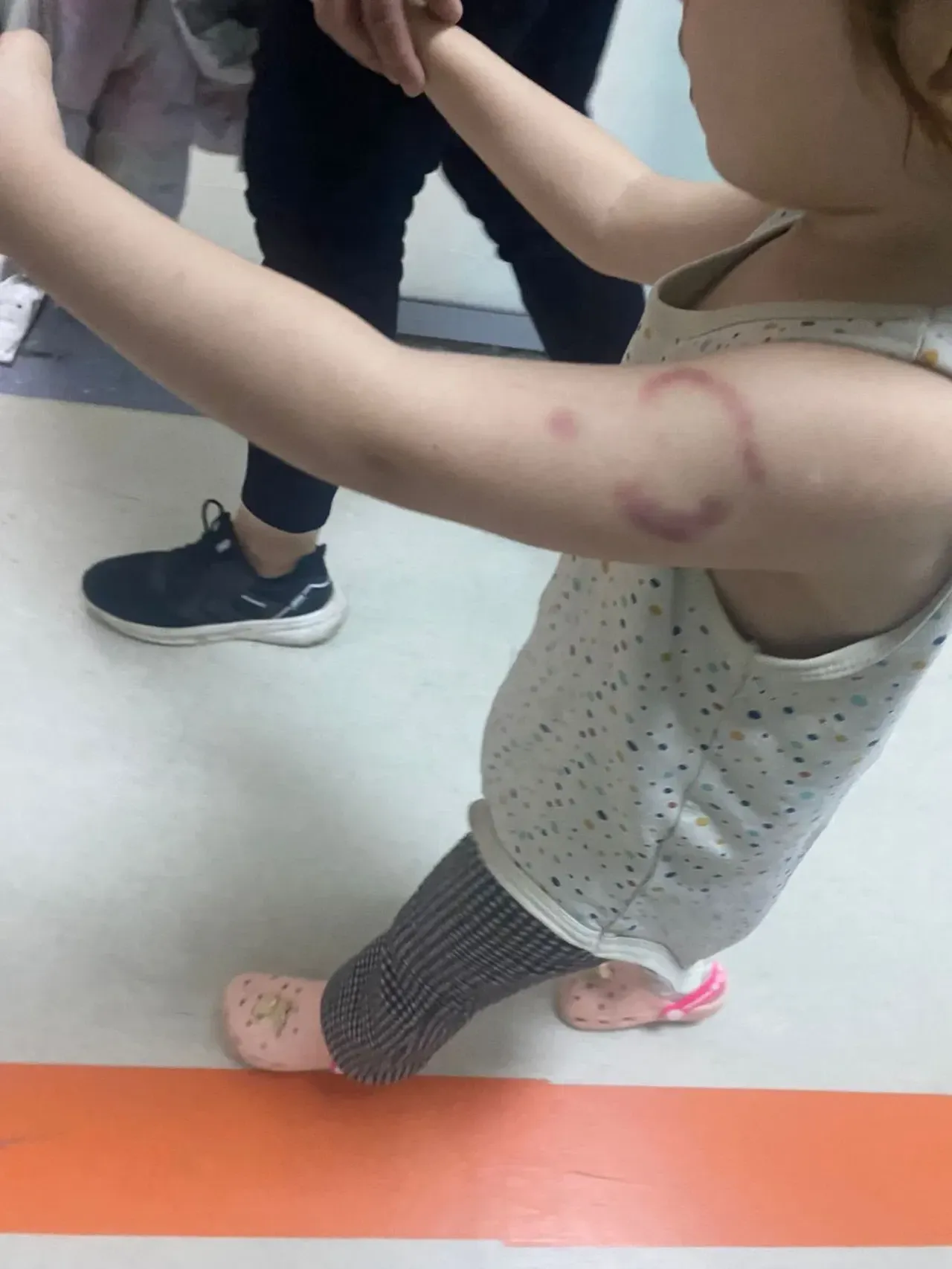 Kreşte 3 yaşındaki çocuğu ısıran bakıcının cezası belli oldu