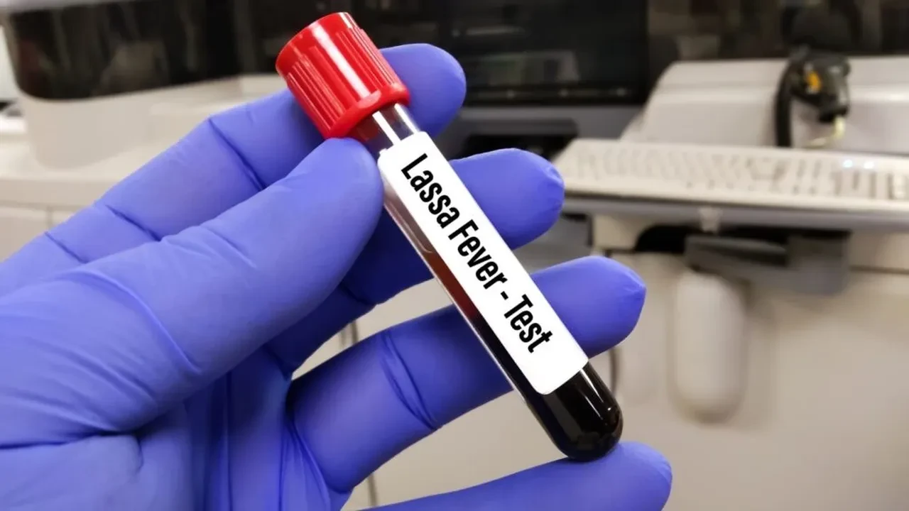 Hayvandan insana bulaşan hastalık onlarca kişiyi öldürdü!