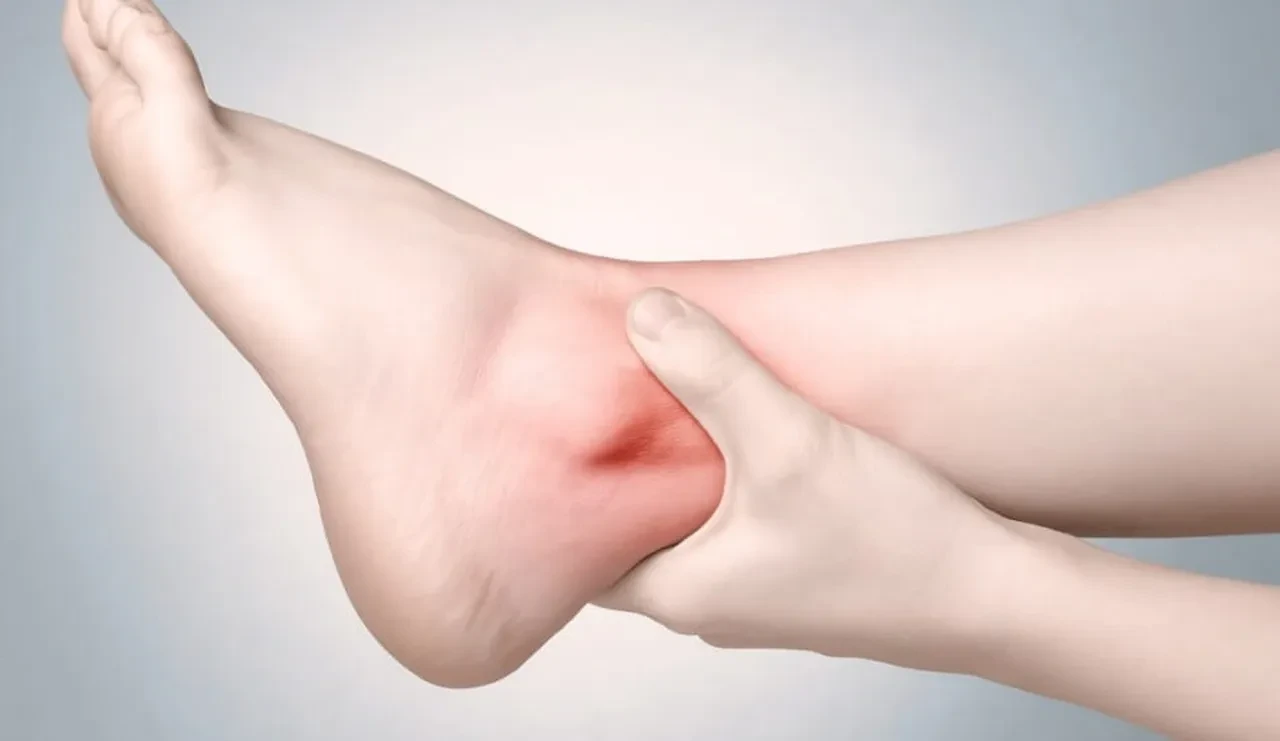 Ödemle baş etmenin etkili yolları! Şişkinliğiniz bu yüzden olabilir