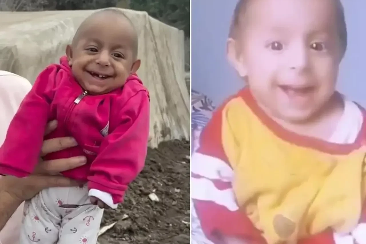 Ökkeş Bebek öldü mü? Herkes onu "Gülen Bebek" olarak tanıyordu: Taziye mesajları yağıyor