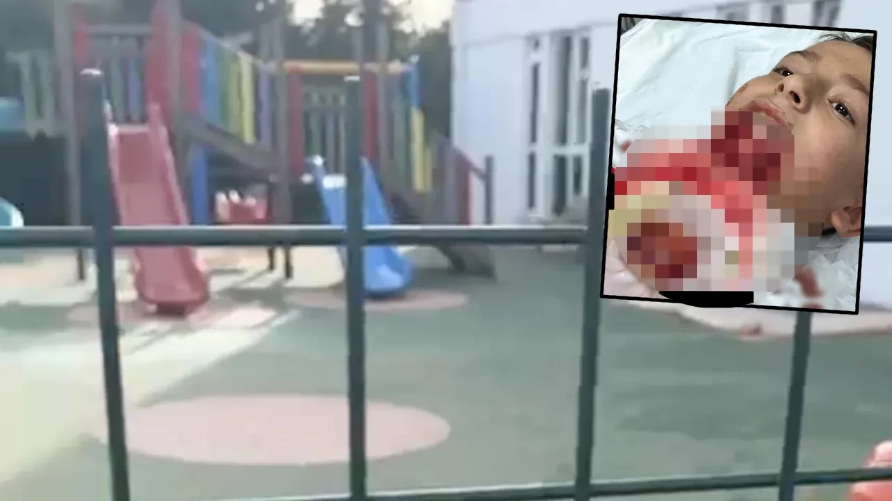 Oyun oynarken çenesi koptu! Ailesi çocuklarını görünce dehşete düştü: Okul yönetiminden skandal savunma 