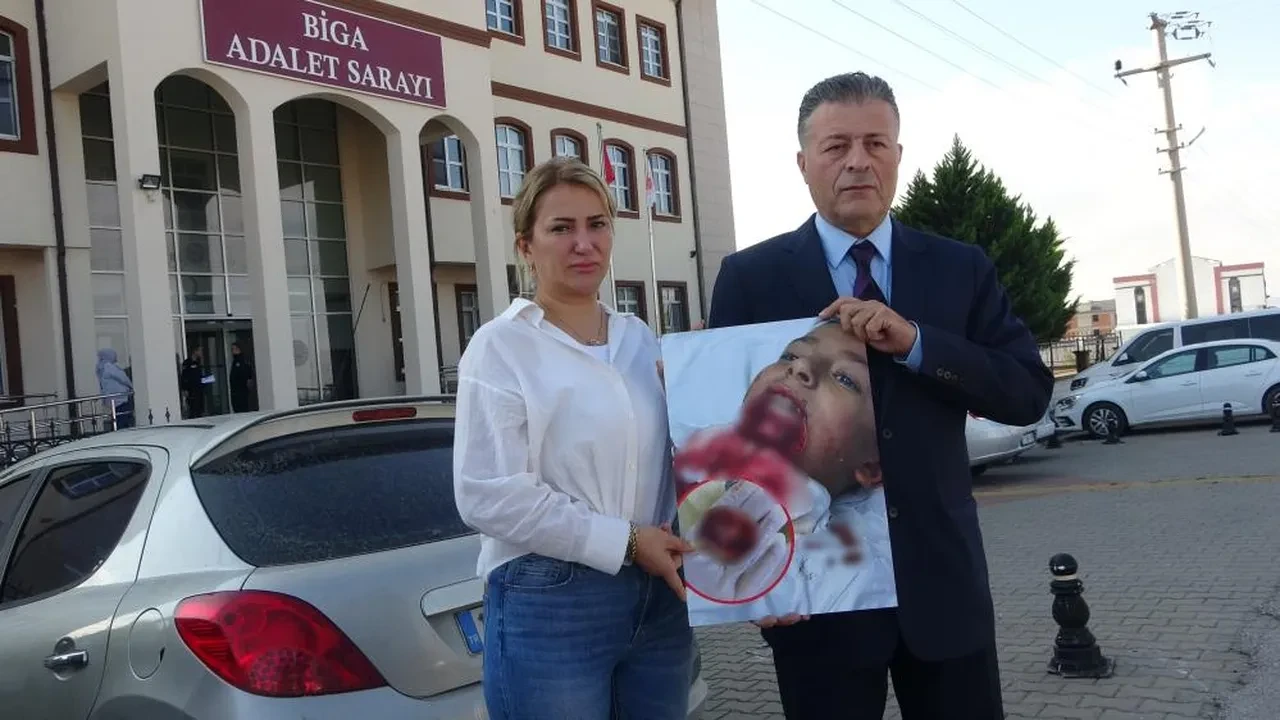 Oyun oynarken çenesi koptu! Ailesi çocuklarını görünce dehşete düştü: Okul yönetiminden skandal savunma