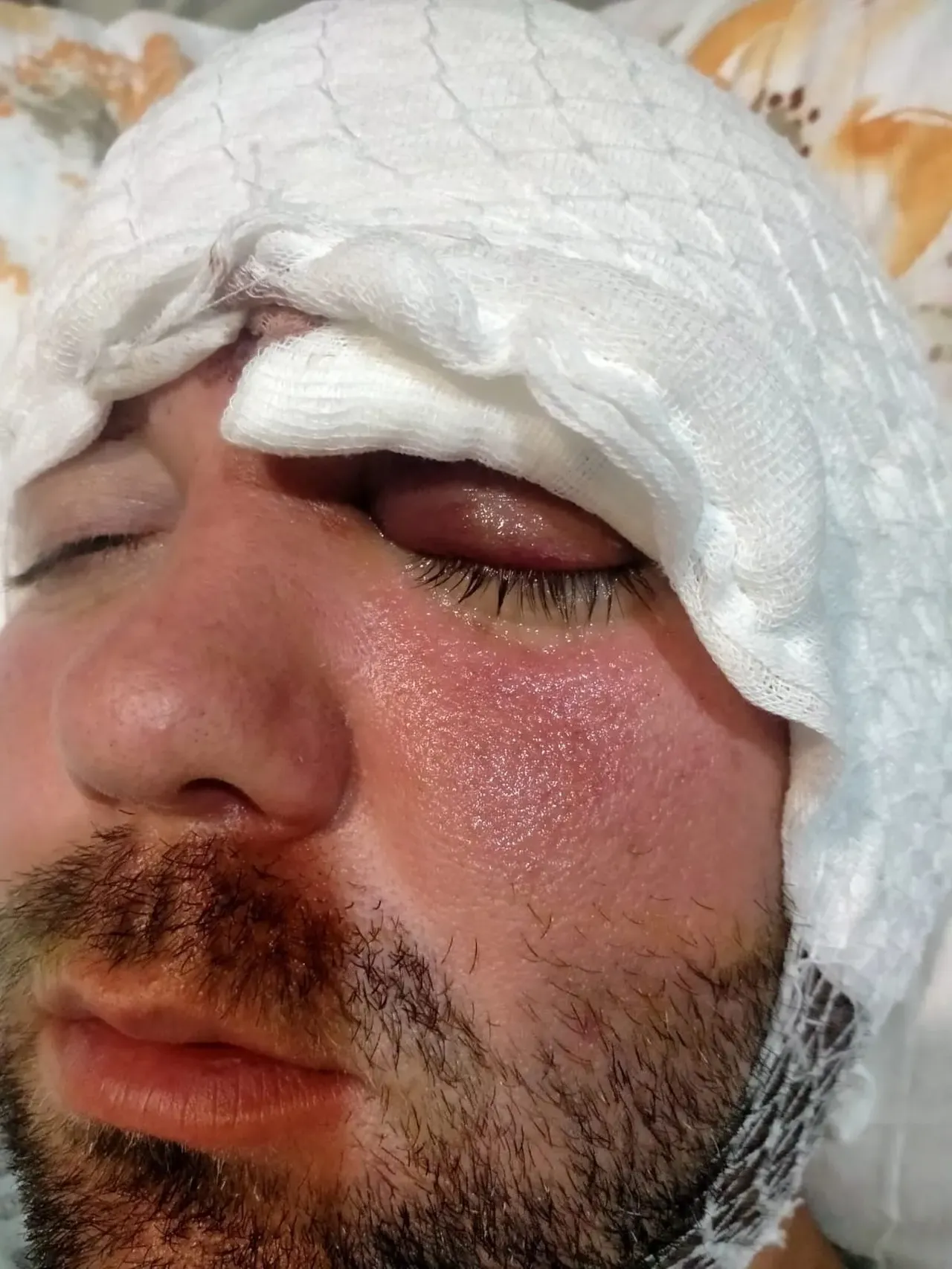 Beynine saplanan implant hayatını kararttı! 2 yıldır adalet bekliyor 