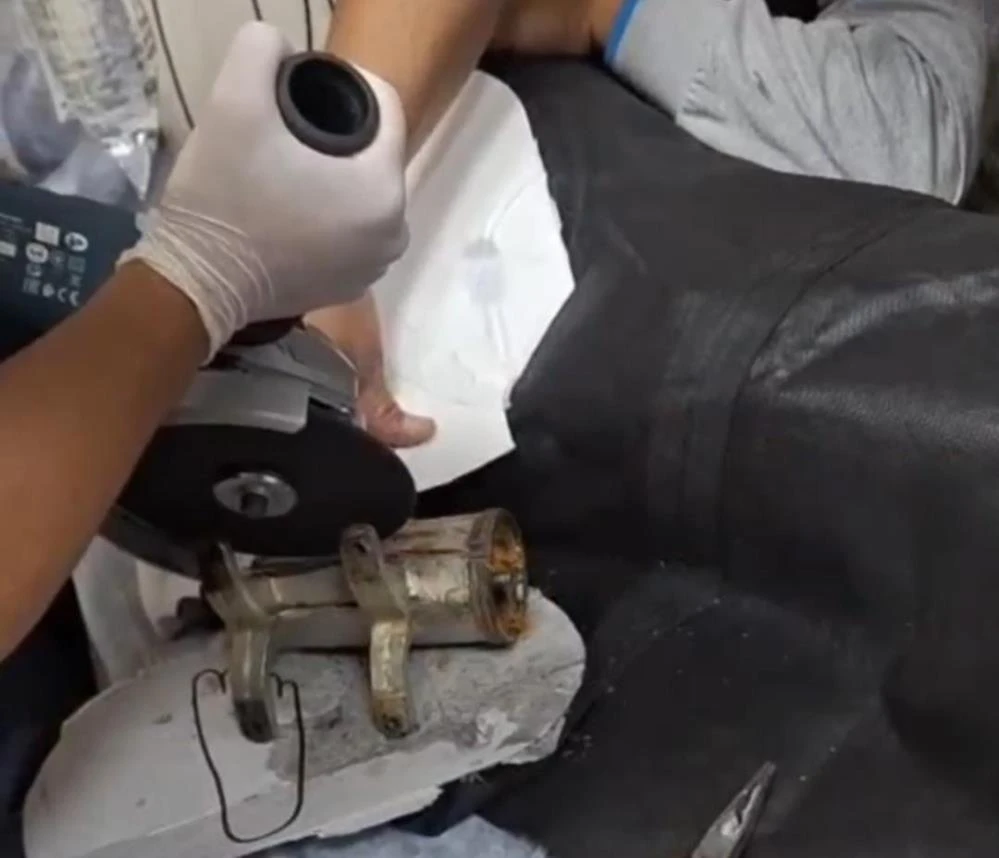 Tel Abyad'ta elini kıyma makinesine kaptıran 8 yaşındaki çocuk kurtarıldı