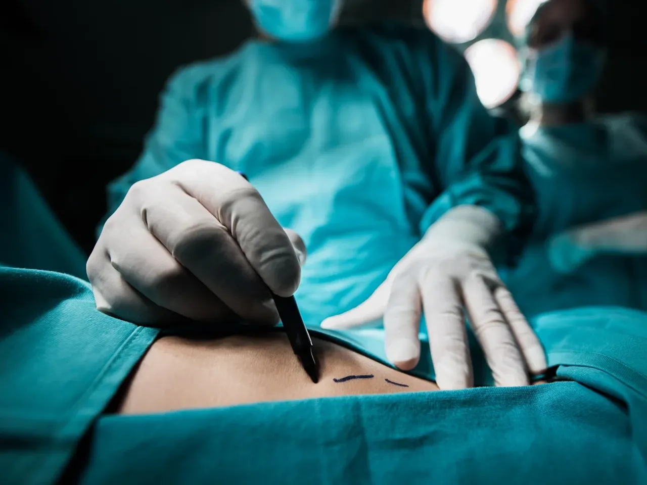 Ameliyata girdi sesinden oldu! Doktorundan skandal savunma: 'Ne olacak başınız ağırmaz'