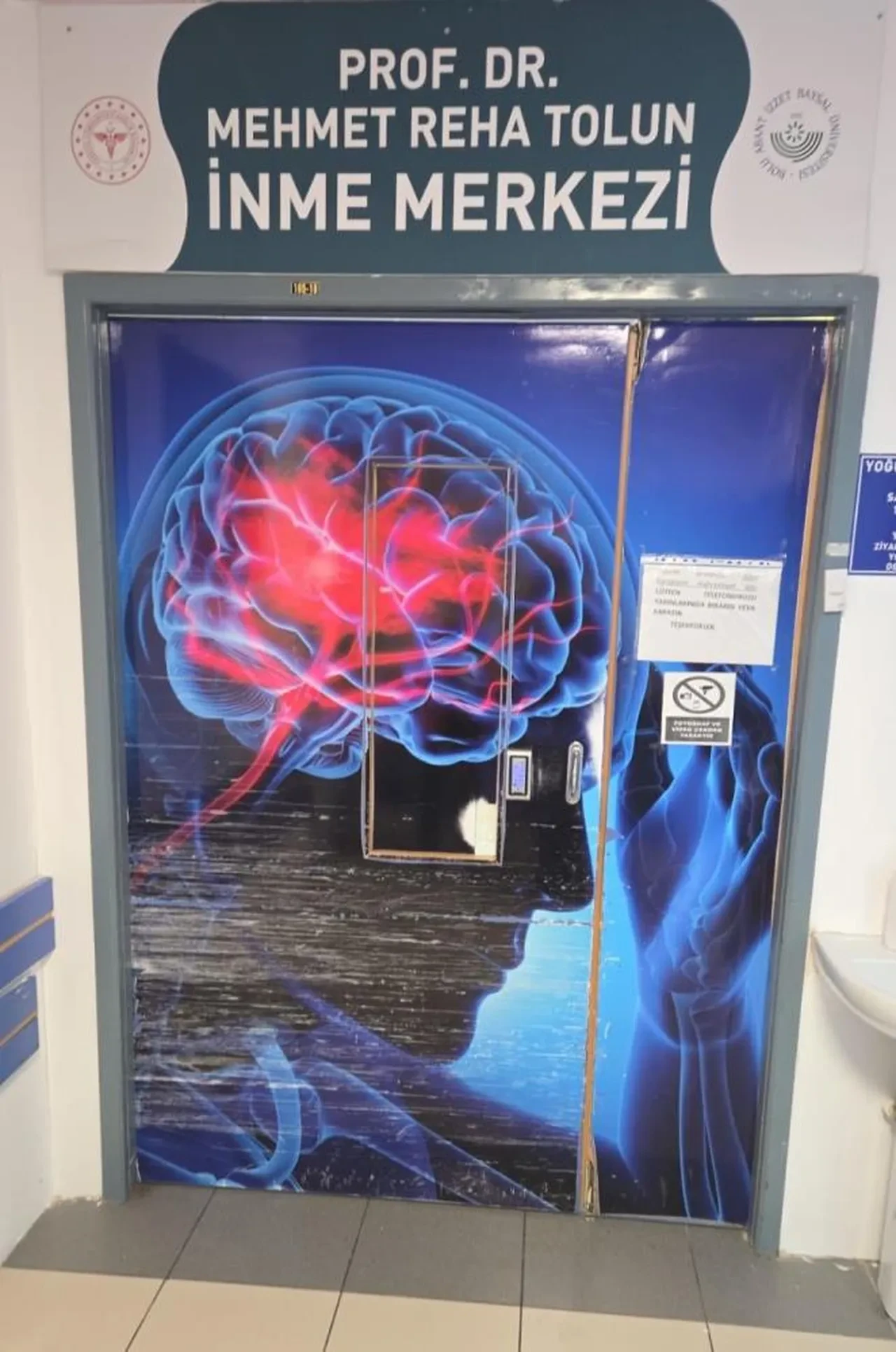 Nöroloji uzmanından inme uyarısı: Erken müdahale felci önler!