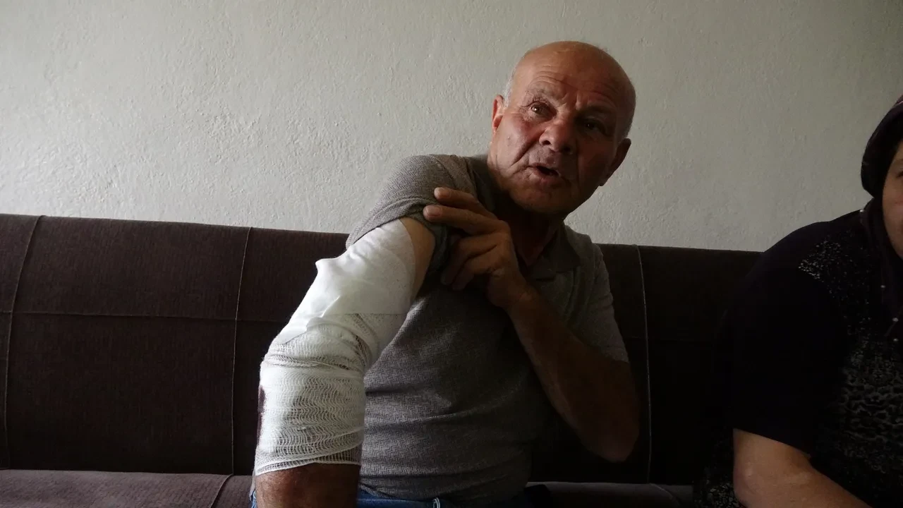 Başıboş sokak köpeği dehşeti bitmiyor! Şefkatle yaklaştı, kolunu kaptırdı