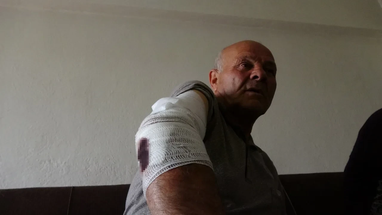 Başıboş sokak köpeği dehşeti bitmiyor! Şefkatle yaklaştı, kolunu kaptırdı