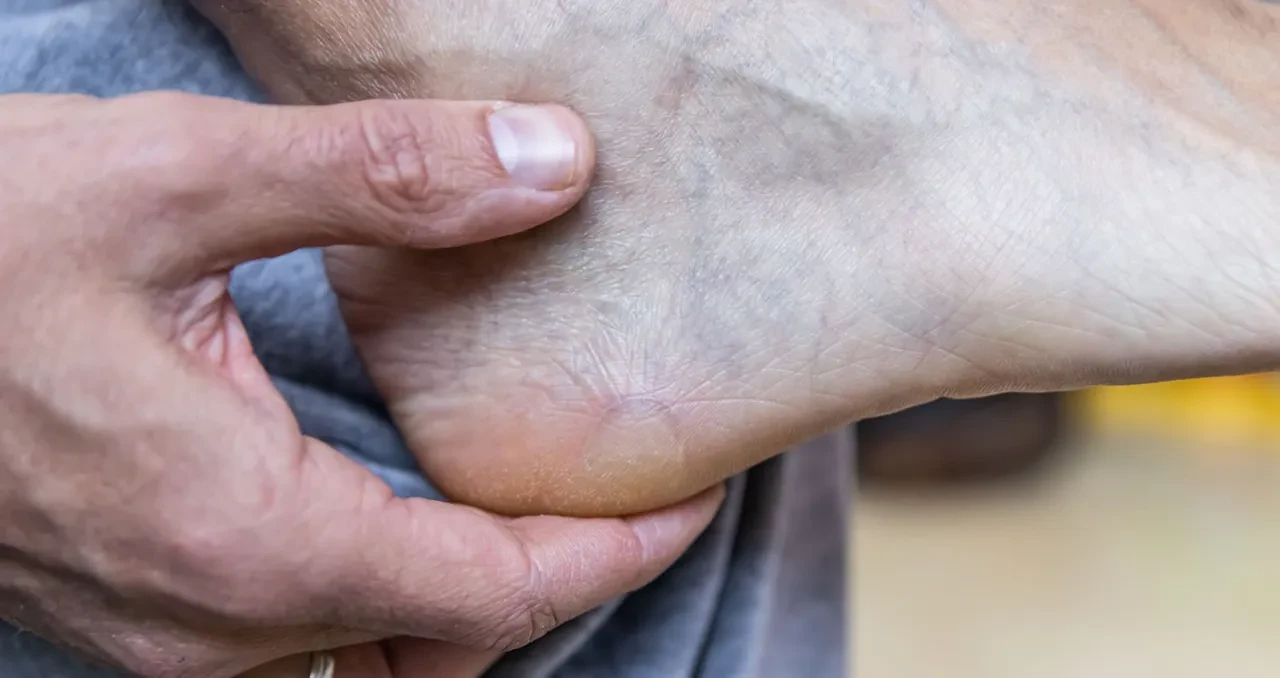 Damar tıkanıklığının doğal kalkanı! Bu besinler vücudunuzu arındırıyor ve kalbinizi koruyor