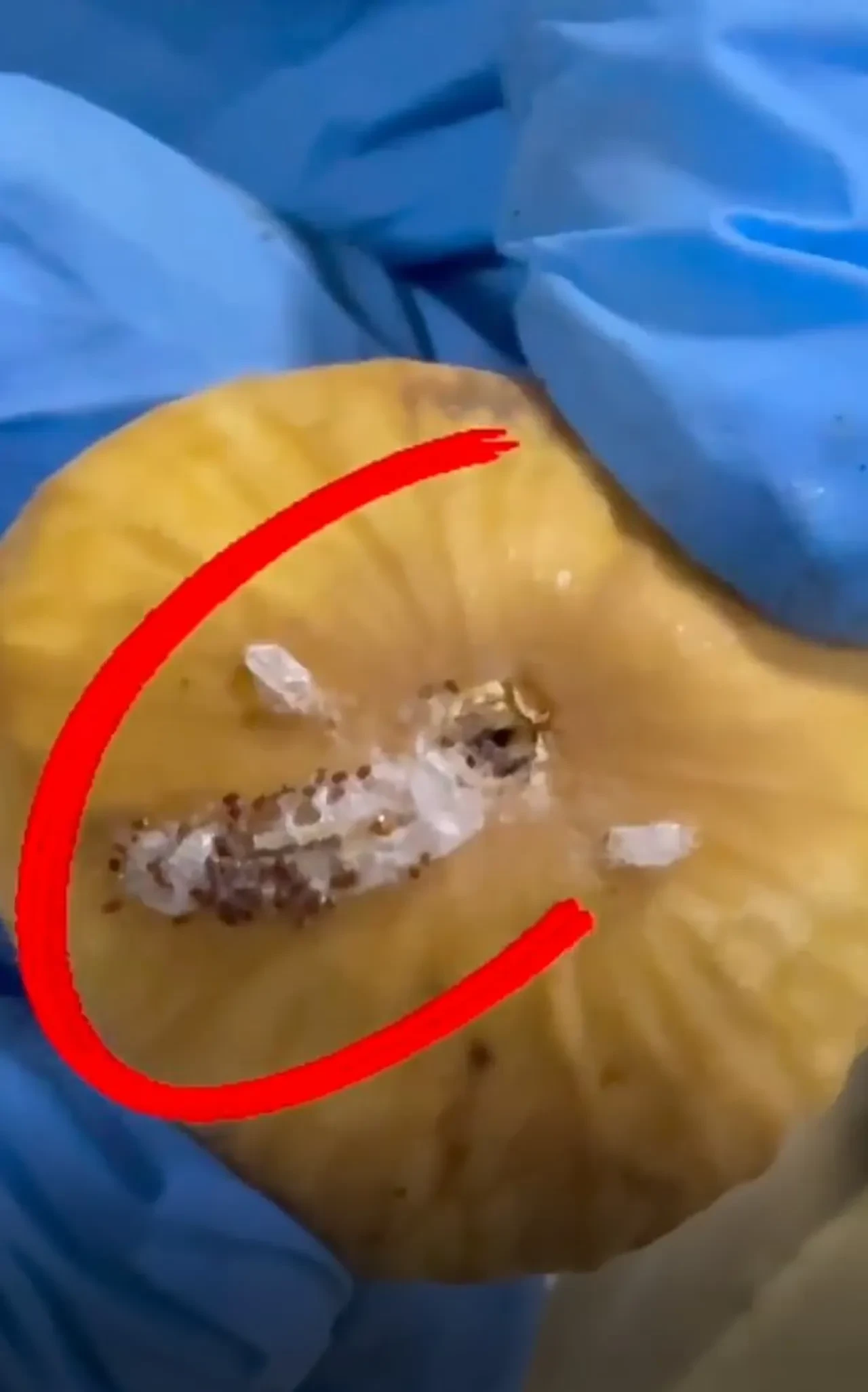 Mide bulandıran görüntüler! Sinek ölüsüne 'çörek otu' savunması