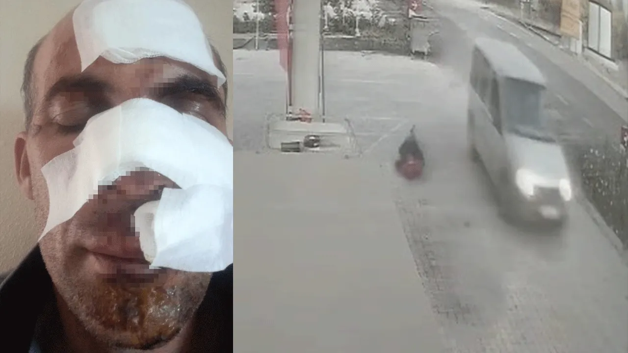 Eniştesine arabayla vurup kaçtı! Arkasına bile bakmadı