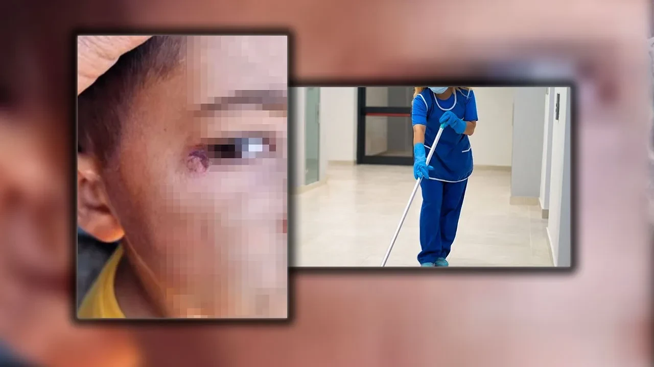 Okulda dehşete düşüren olay! İlkokul öğrencisinin yüzünde sigara söndürdü