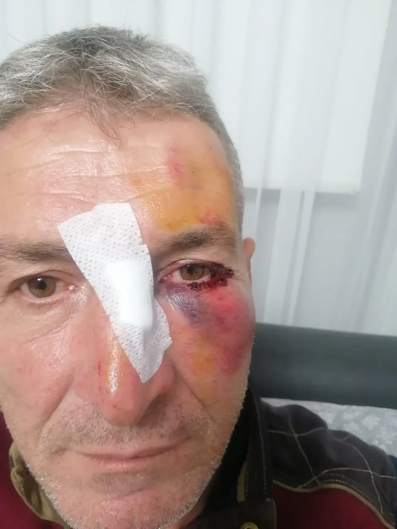 Bursa'da komşu terörü! Mahallelileri bile hayattan bezdirdi