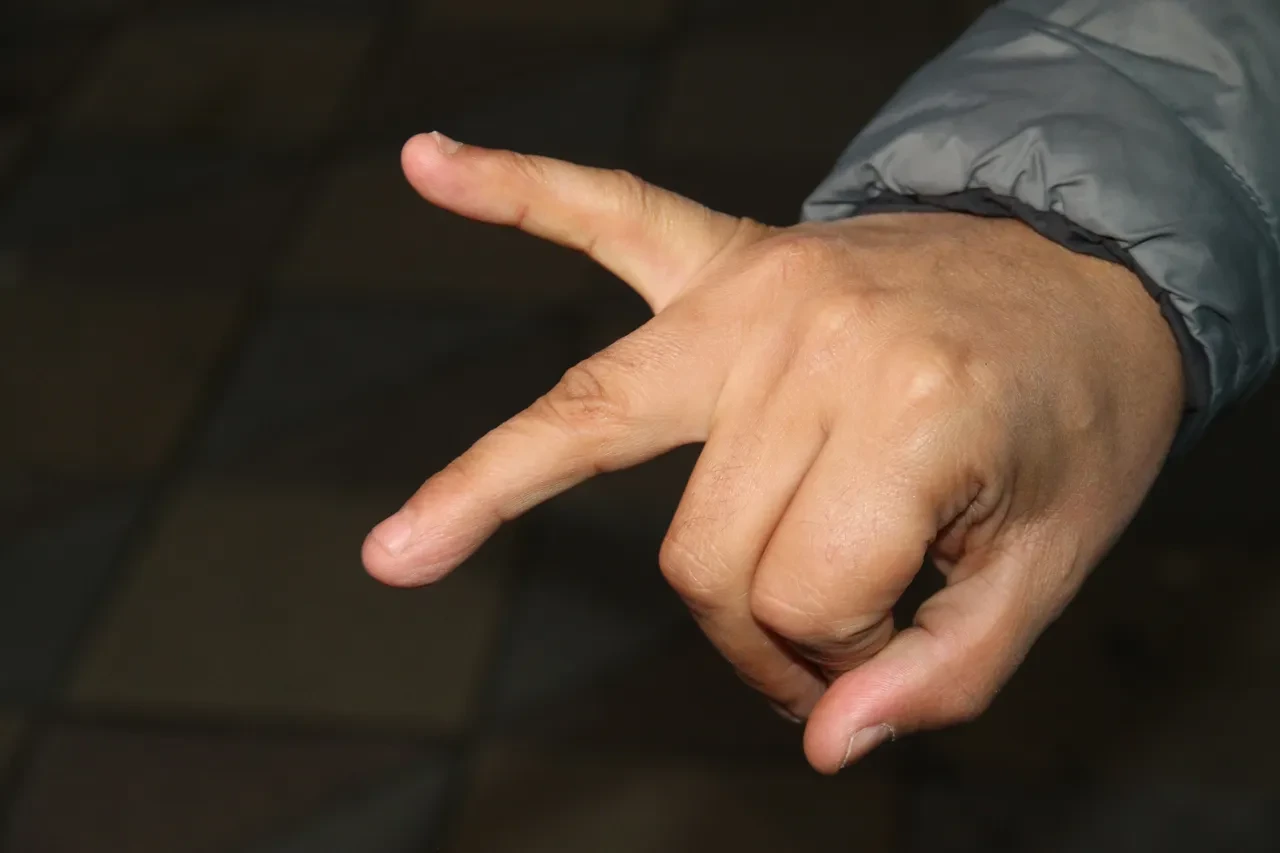 Balıkla adam dövdüler! İade etmek istedi, parmağından oldu: 'Bana çupra ile vurdular!' 