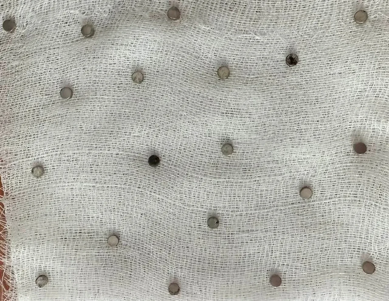 Çocuğun boğazından çıkanlar şoke etti! Tam 19 adet: Doktorlar inanamadı