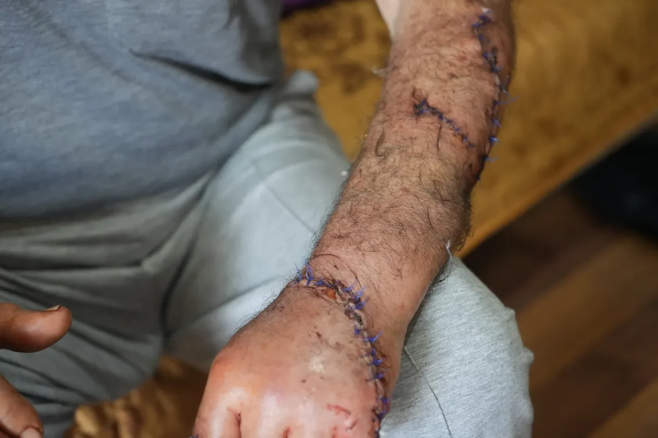 Kendisini 17 yerinden bıçaklayan karısını bankta yatarken gördü! Verdiği karar hayatını kararttı