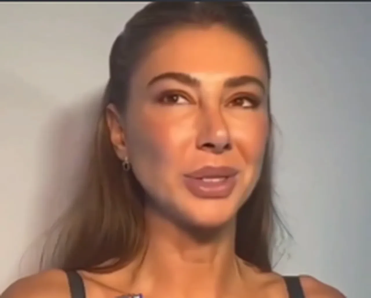 Şeyma Subaşı estetiği abartınca konuşmakta güçlük çekti