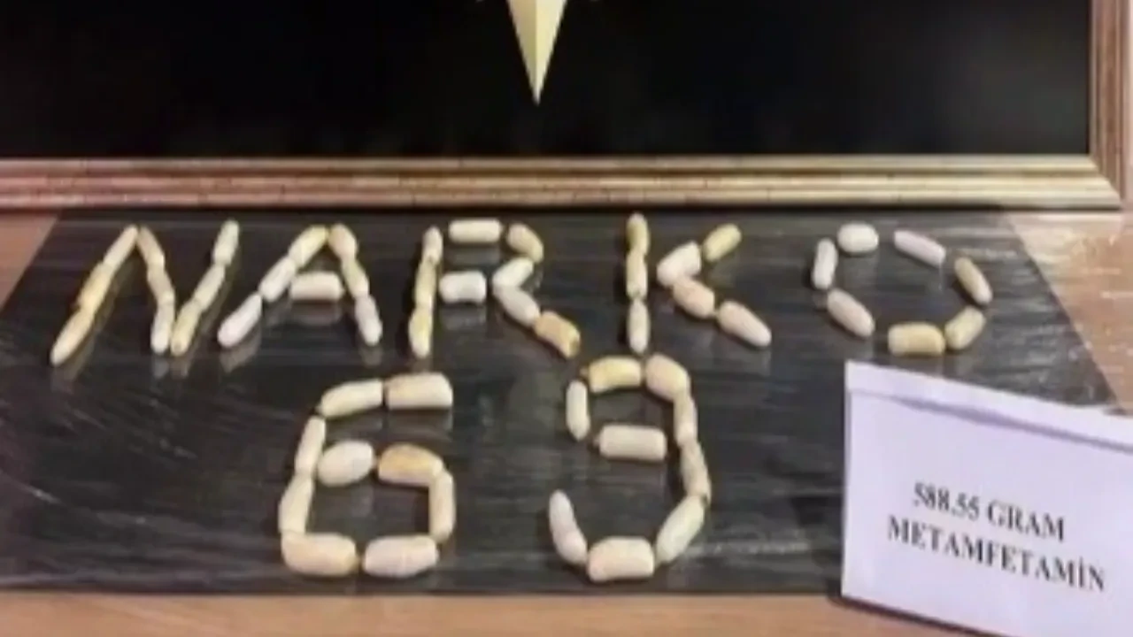Midesinden çıkanlar hayrete düşürdü! Tam yarım kilo ağırlığında