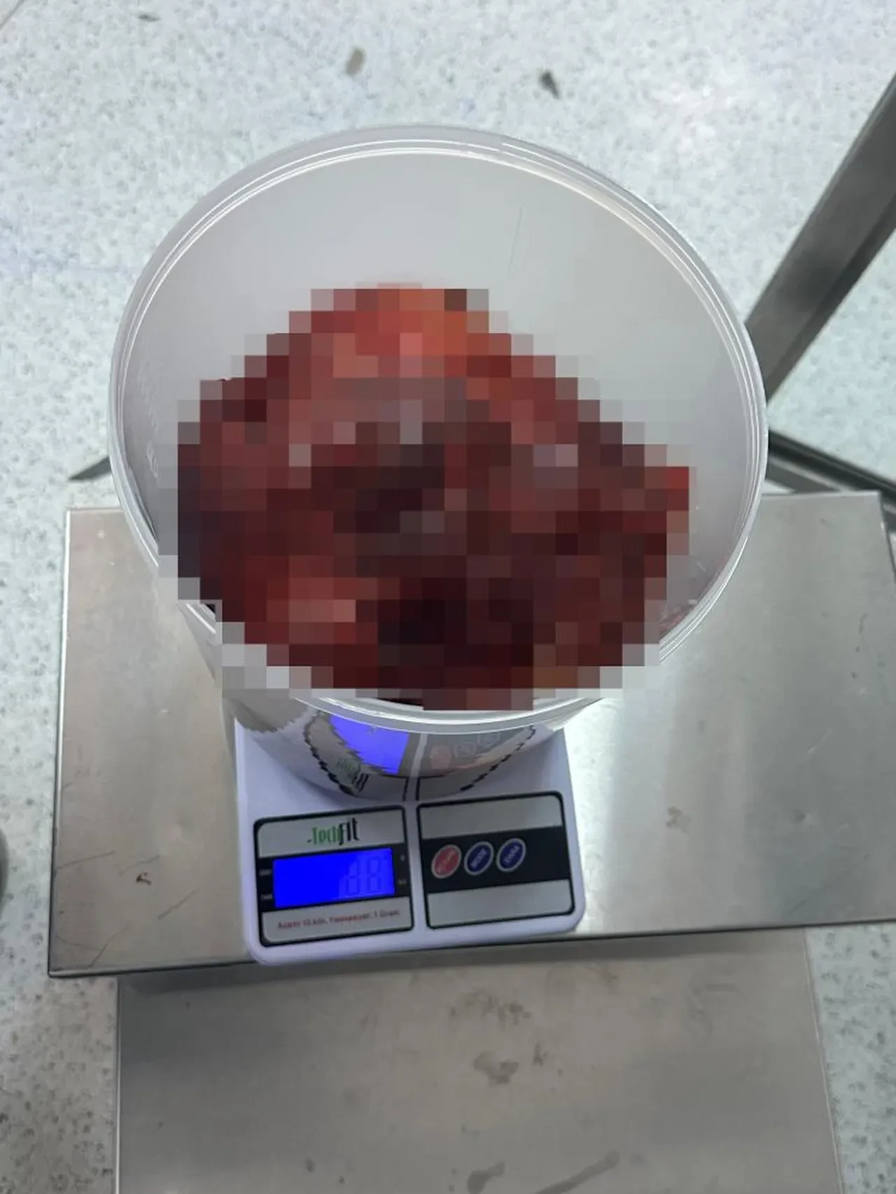 Ameliyatına 5'i cerrah 10 kişilik ekip girdi: Çıkışta poz verdiler