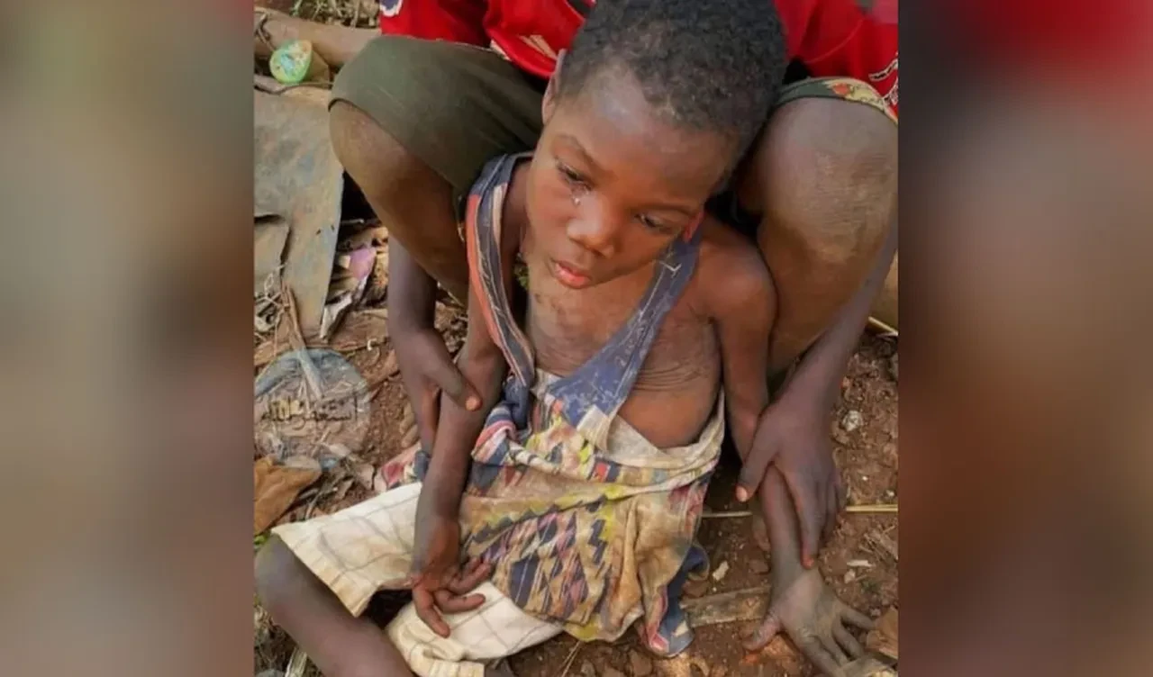 Sudan'da insanlık ölüyor! Cumhurbaşkanı Erdoğan dünyaya seslendi