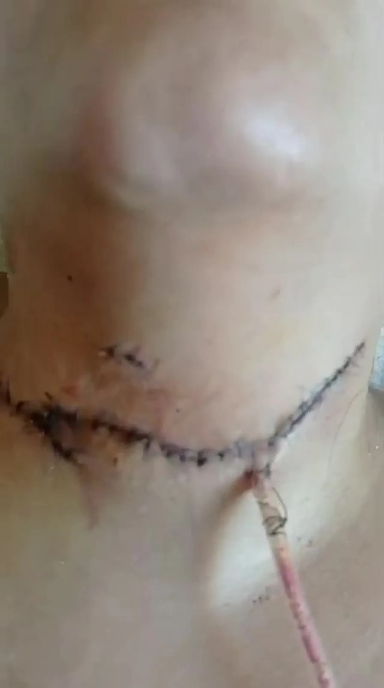 Çocuklarının gözü önünde boğazını kesti! Engelli kalan anne çocuklarını geri istiyor