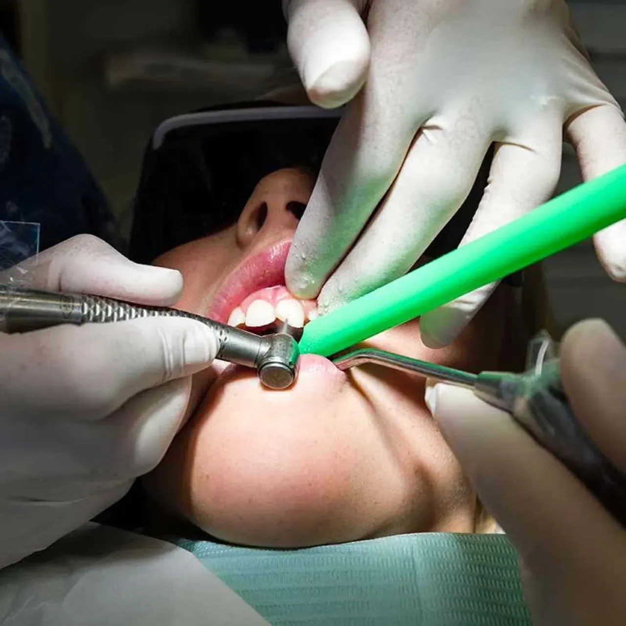 Diş çürüğü sorunu, yeni yöntem sonrası tarihe karışabilir! Bilim insanları 'imkansızı' başardı