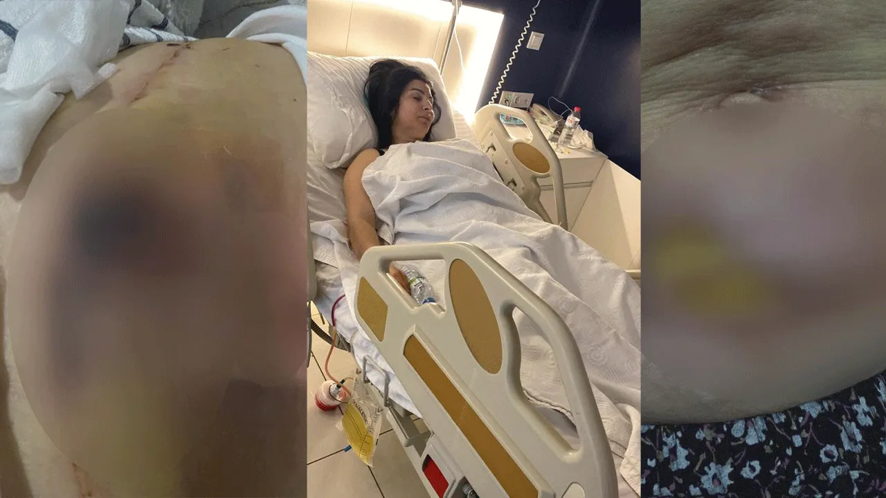 Güzelleşmek istedi hayatı karardı! Oturamıyor, kalkamıyor, eğilemiyor!