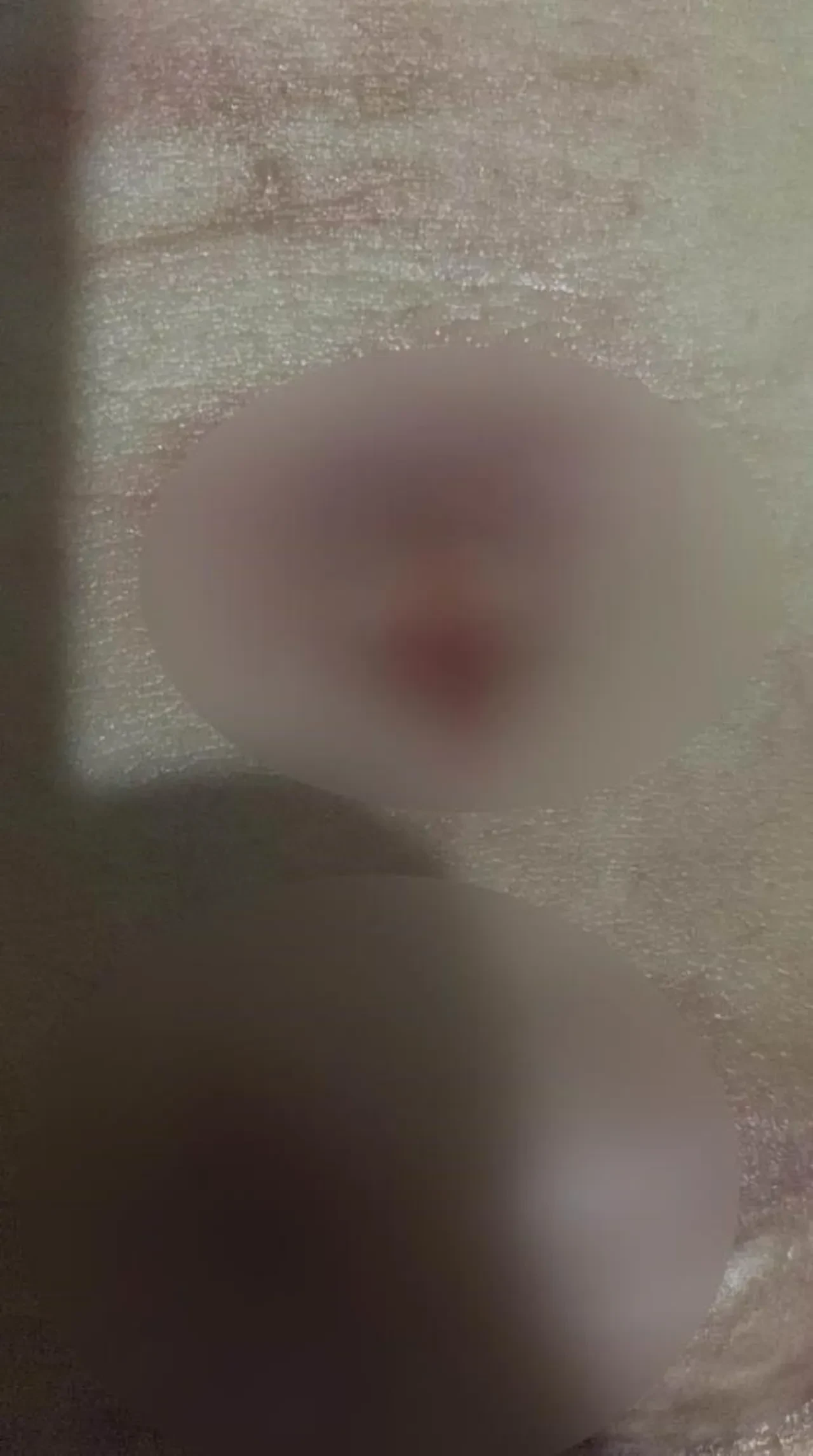 Güzelleşmek istedi hayatı karardı! Oturamıyor, kalkamıyor, eğilemiyor!