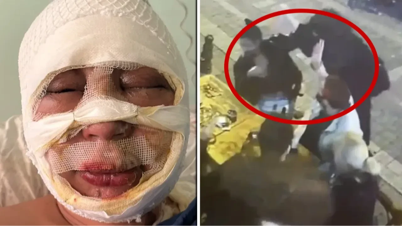 Kadıköy’de kan donduran vahşet! Ateşe verilen genç kadın dehşet anlarını anlattı 