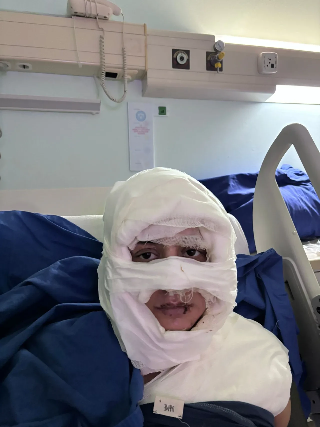 Kadıköy’de kan donduran vahşet! Ateşe verilen genç kadın dehşet anlarını anlattı 