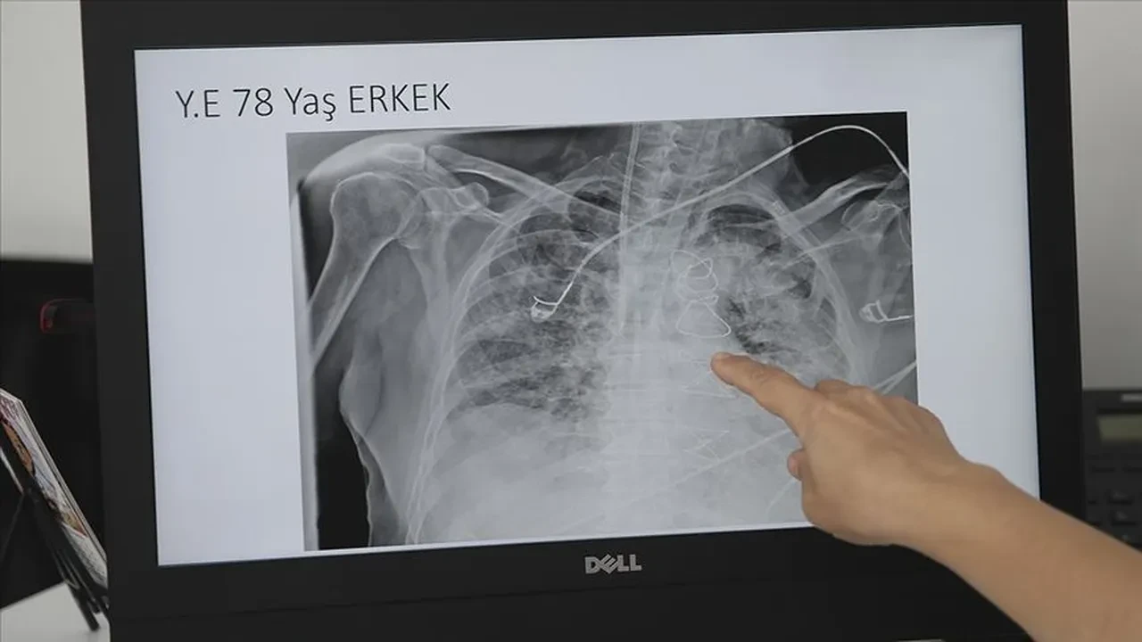 Uzman doktor uyardı: Hafife alınan öksürük ölümünüze neden olabilir