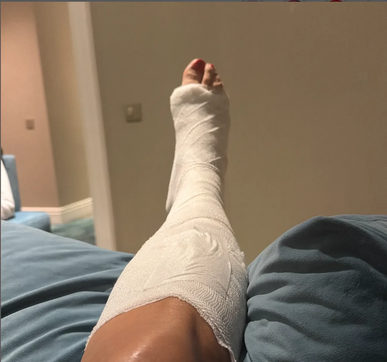 Işın Karaca sahnede düştü! Son sağlık durumu sevenlerini üzdü