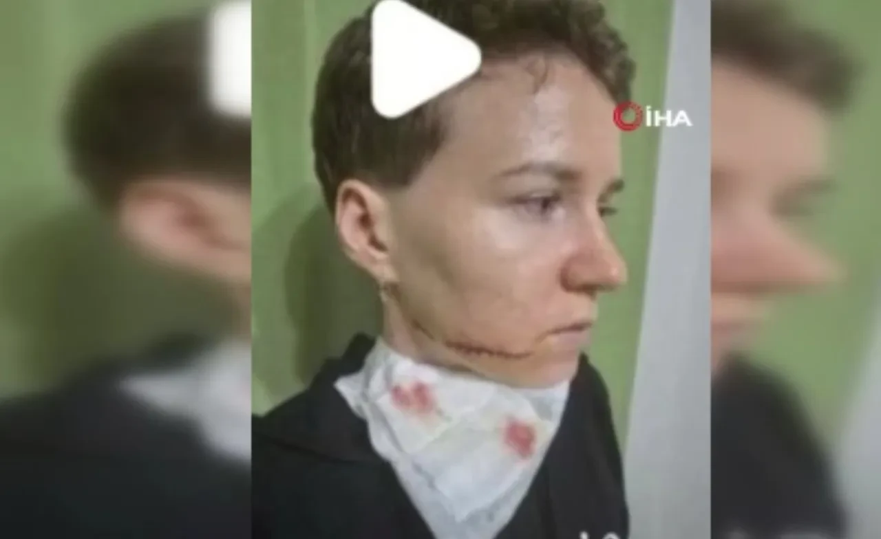 Sokak ortasında dehşet! Kadına yumruk atıp, makasla yüzünü kesti: Savunması 'pes' dedirtti