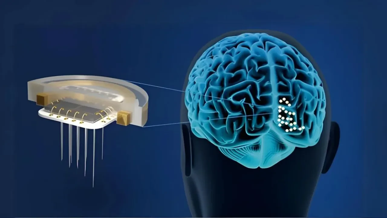 Beyin çiplerinde ameliyat devri bitiyor: MIT'den iğneyle enjekte edilen teknoloji