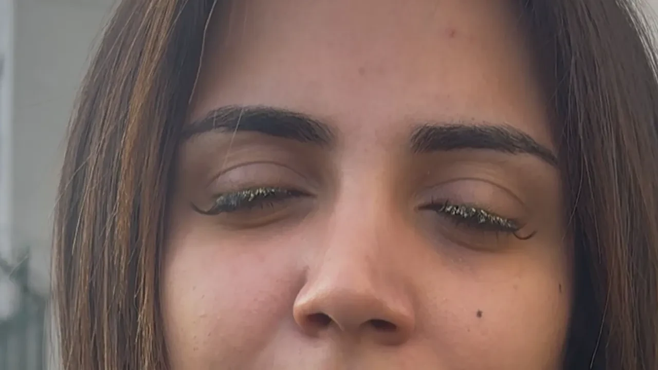 Kirpiği için gözünden oluyordu! Gözüne yapıştırıcı kaçtı, genç kadın kısmi körlük yaşadı