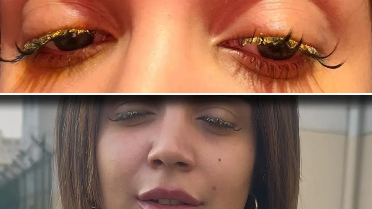 Kirpiklerini yaptırmak istedi, dehşeti yaşadı! 'Kör olabilirdim' 