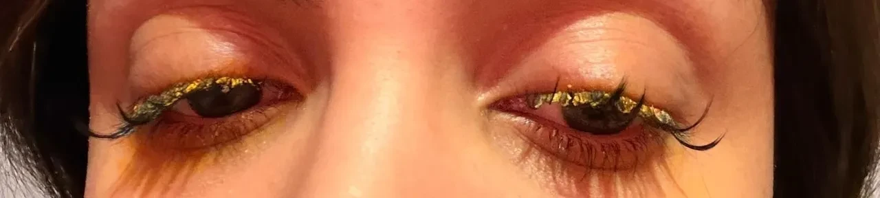 Güzellik merkezinde dehşet! Kirpiklerini yaptırmak istedi, soluğu hastanede aldı: 'Kör olabilirdim'