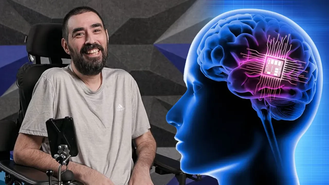 Elon Musk'ın beyin çipi taktığı insanlara ne oldu? Sırra kadem basan hastanın eşi gerçekleri anlattı