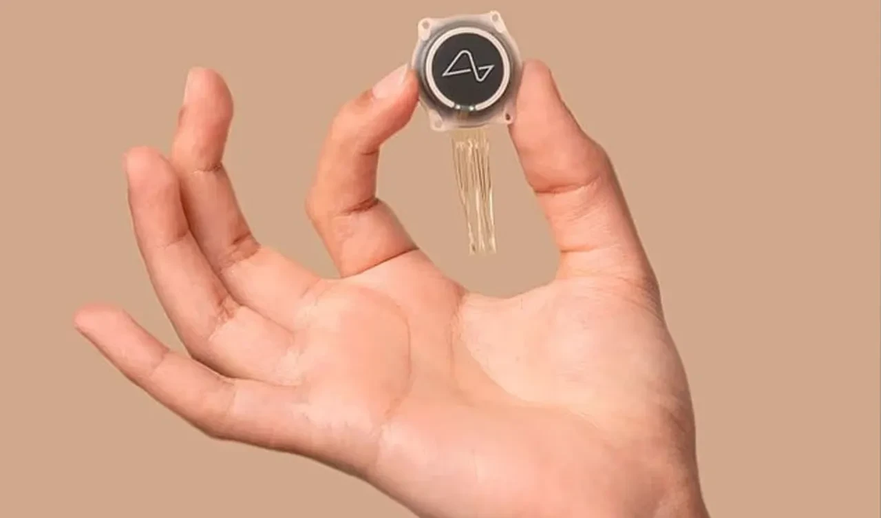 Elon Musk'ın beyin çipi taktığı insanlara ne oldu? Sırra kadem basan hastanın eşi gerçekleri anlattı